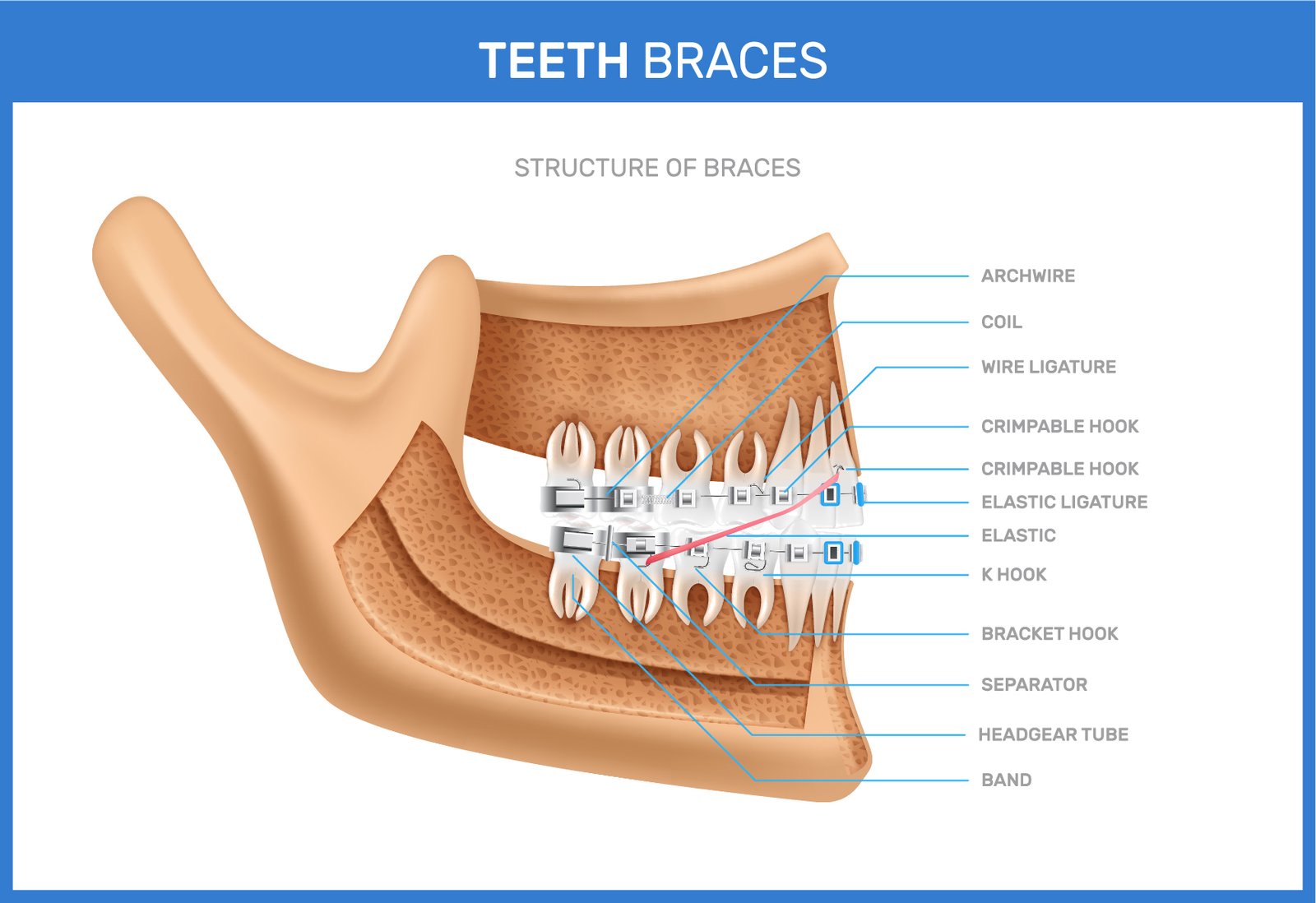 teeth braces realistic edc