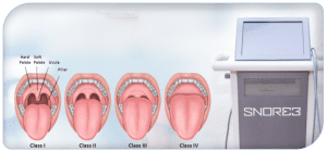 Snoring Solution Snoring and Oral Health