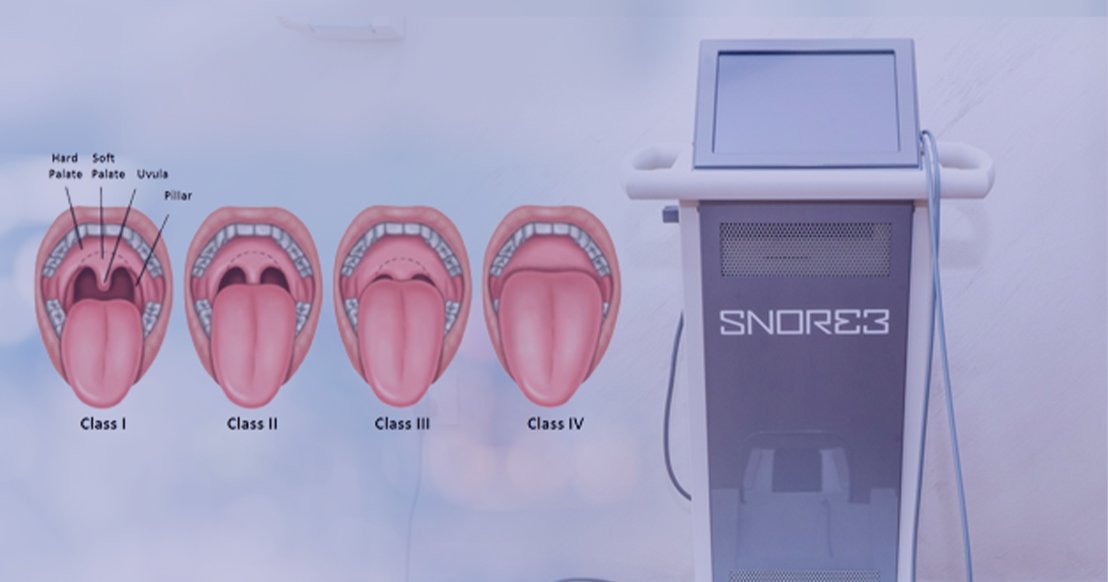 snoring1011x500