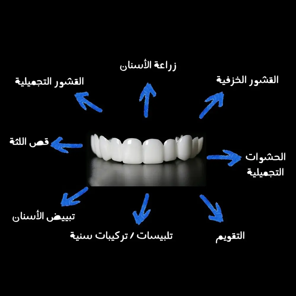 تفاصيل طب الأسنان التجميلي