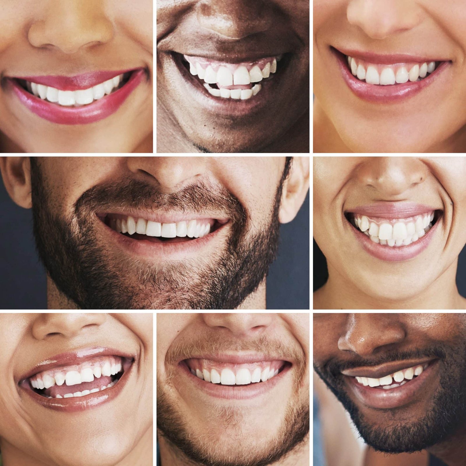 With Us… Smile with confidence