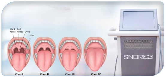 The Relationship Between Snoring and Oral Health