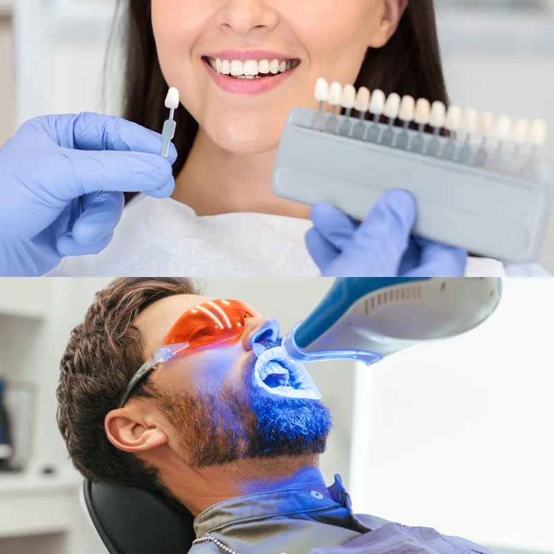 الخدمات التجميلية في عيادة الأسنان| أفضل عيادة تجميل أسنان في الأردن